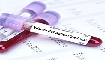 blood sugar test pathology lab