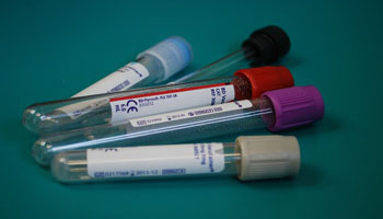 ESR test pathology lab