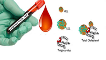 LIPID test